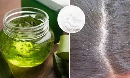 Natural Dandruff Remedy Natural Dandruff Remedy