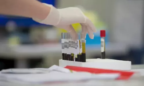 Health Mission-100 : తెలంగాణలో హెల్త్ మిషన్-100 షురూ.. మార్చి 2 నుంచి 100 రోజుల పాటు ఆరోగ్య పండగ Health Mission-100 : తెలంగాణలో హెల్త్ మిషన్-100 షురూ.. మార్చి 2 నుంచి 100 రోజుల పాటు ఆరోగ్య పండగ