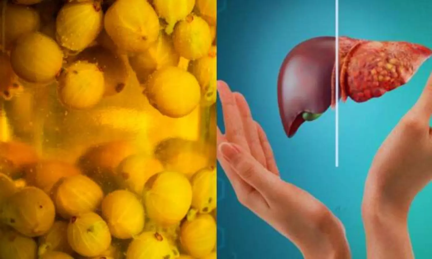 Fatty Liver: లివర్ క్లీన్ కావాలా? ప్రతిరోజూ ఈ ఒక్క కాయ తింటే ఫ్యాటీ లివర్ మటాష్..! Fatty Liver: లివర్ క్లీన్ కావాలా? ప్రతిరోజూ ఈ ఒక్క కాయ తింటే ఫ్యాటీ లివర్ మటాష్..!