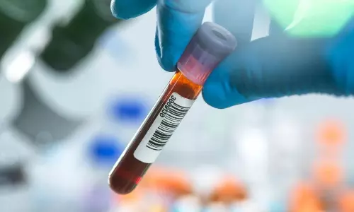 Health Tips: మూత్రంలో రక్తం పడుతోందా? అది కిడ్నీ క్యాన్సర్కు సంకేతం కావచ్చు! Health Tips: మూత్రంలో రక్తం పడుతోందా? అది కిడ్నీ క్యాన్సర్కు సంకేతం కావచ్చు!