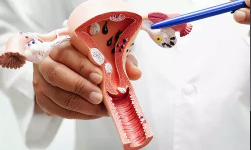 Cervical Cancer Symptoms