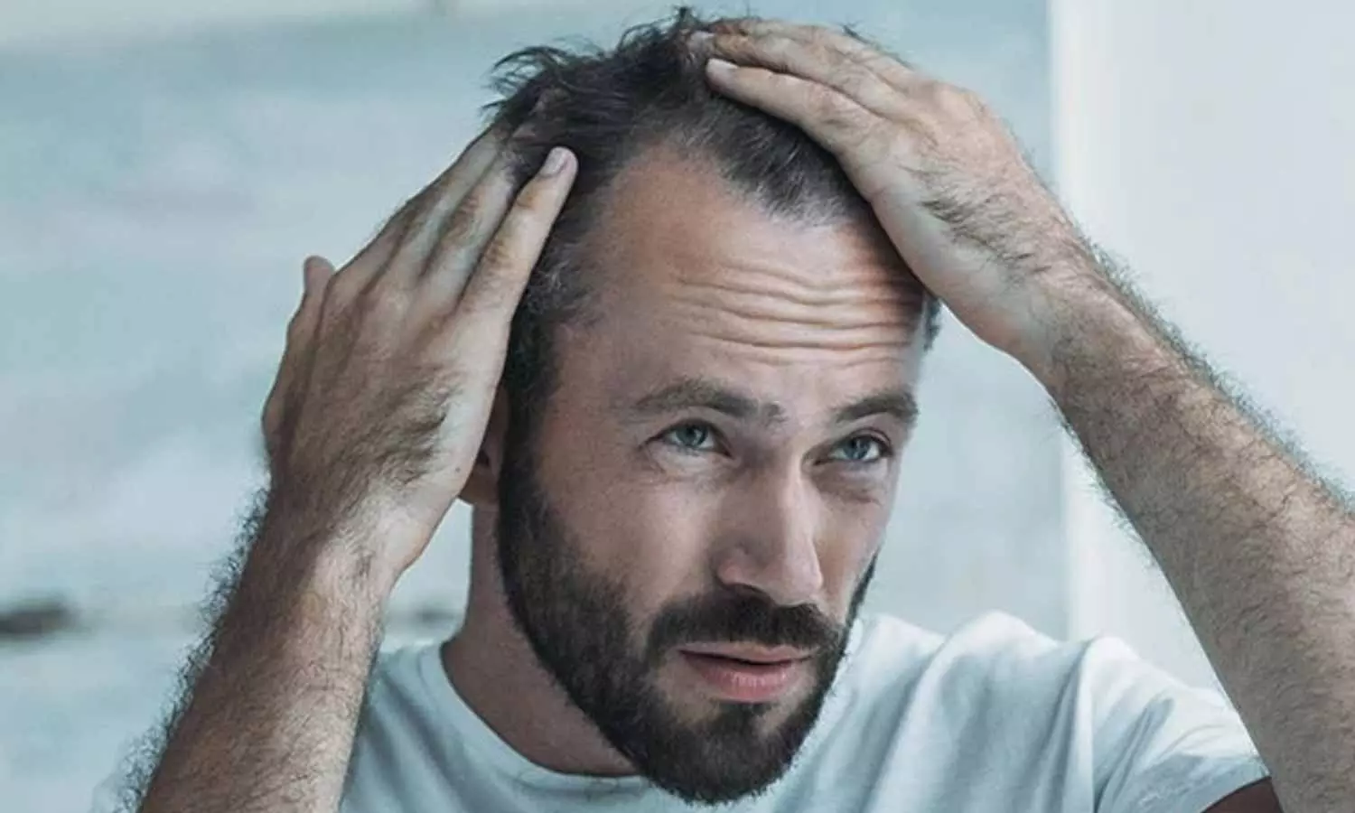 Hair Loss Tips Hair Loss Tips