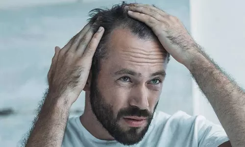 Hair Loss Tips