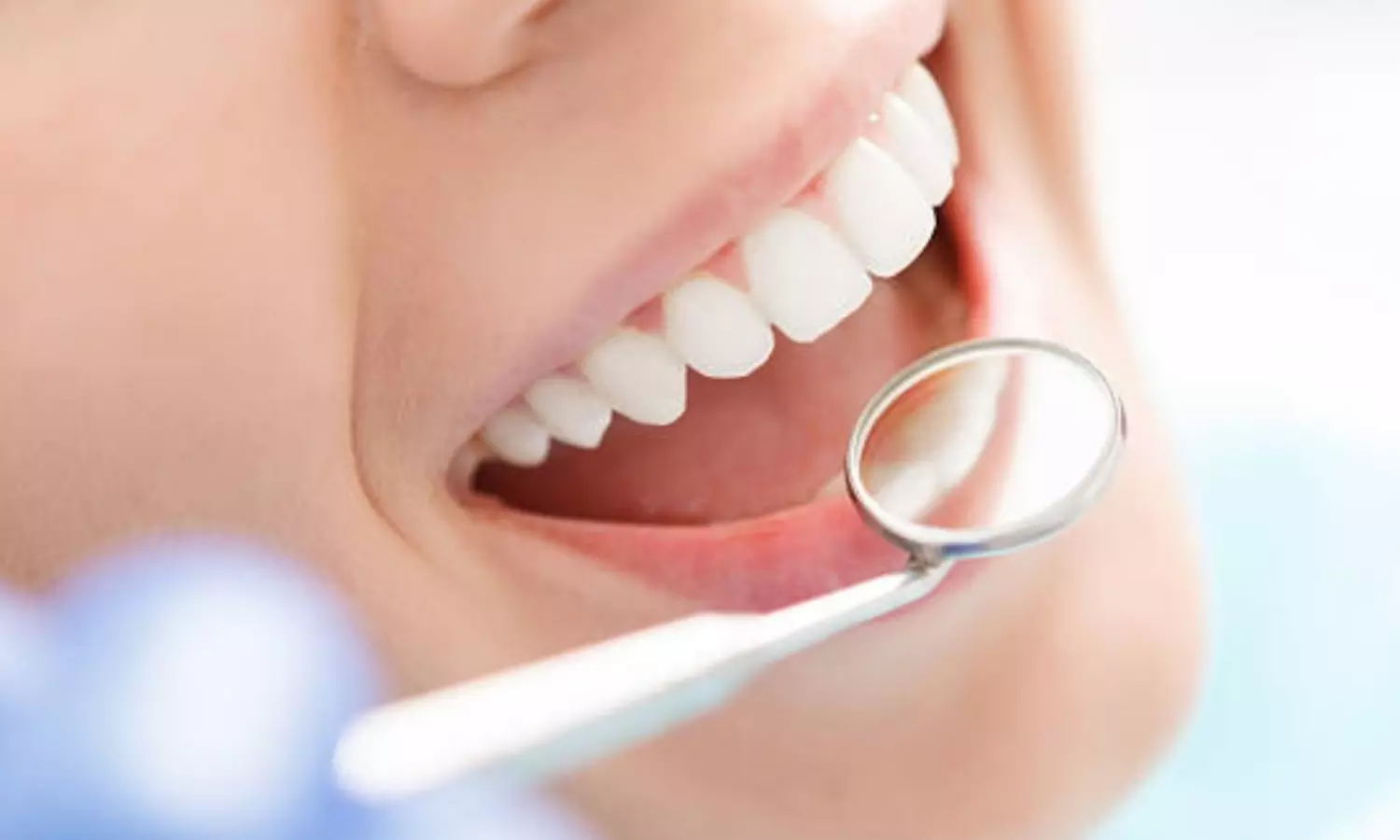 Dental Health Dental Health