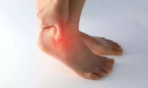 Uric Acid Symptoms Uric Acid Symptoms