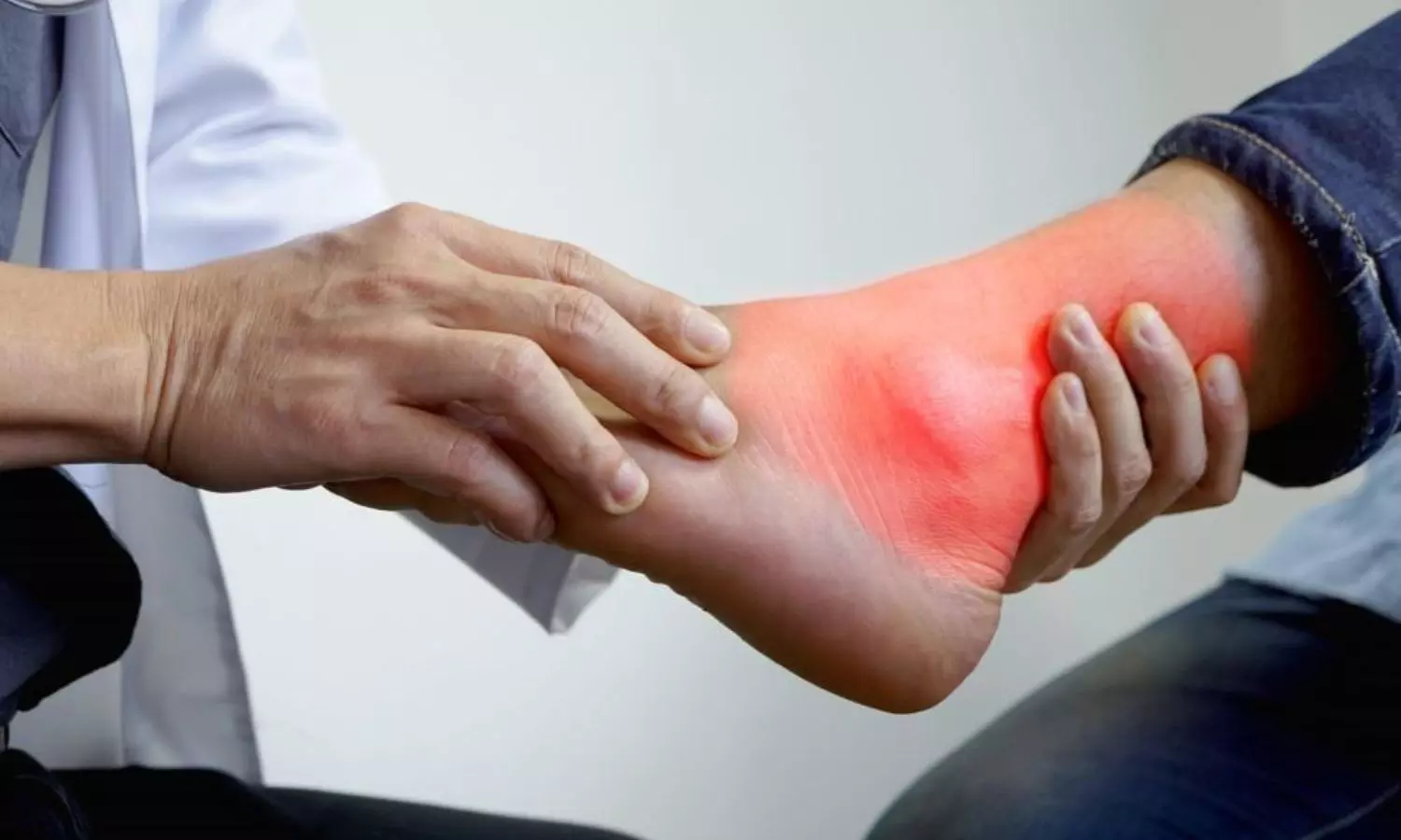 Uric Acid Problem Uric Acid Problem