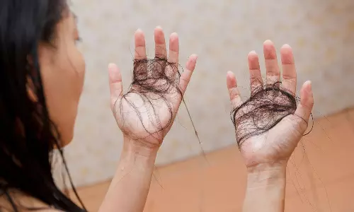 Dream Meaning Dream Meaning