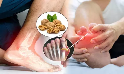 Uric Acid Control: యూరిక్ యాసిడ్ ముప్పు తప్పించుకోవాలా? అయితే ఇది తినాల్సిందే!