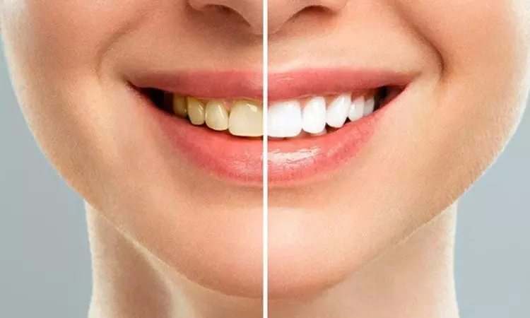 Teeth Yellow Teeth Yellow