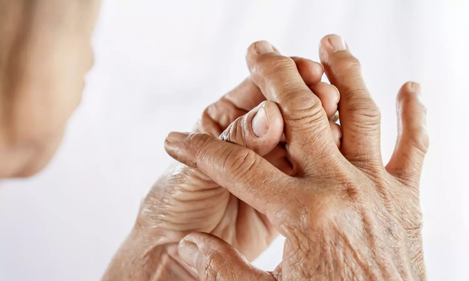 Autoimmune Disease Autoimmune Disease