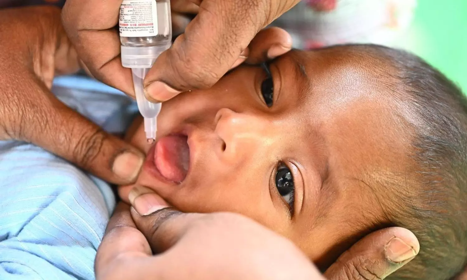 Polio