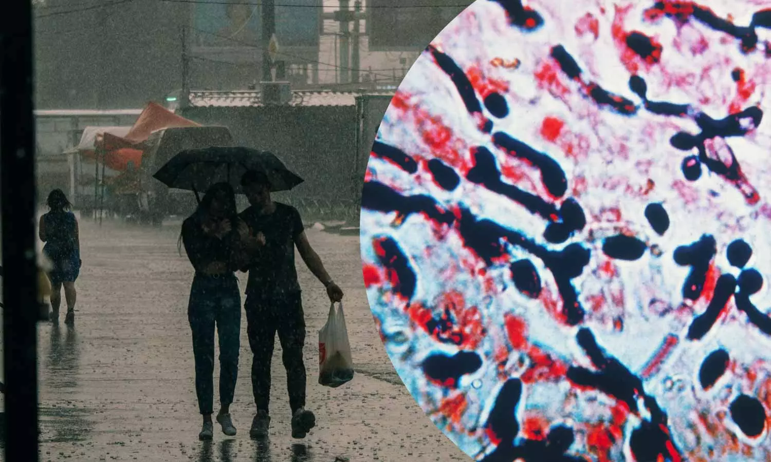 Leptospirosis Risk