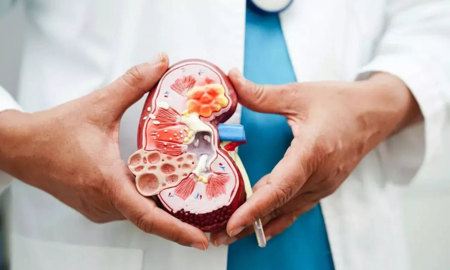 Kidney Health