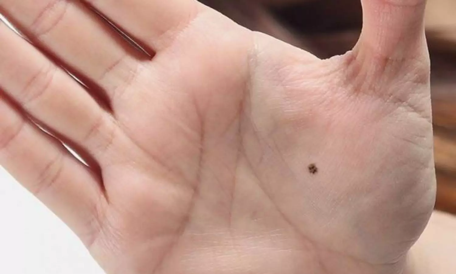 Lucky Mole Signs: హస్తసాముద్రిక శాస్త్రం చెప్పినట్టుగా ఈ స్థానంలో పుట్టుమచ్చ ఉందా... రాజయోగమే Lucky Mole Signs: హస్తసాముద్రిక శాస్త్రం చెప్పినట్టుగా ఈ స్థానంలో పుట్టుమచ్చ ఉందా... రాజయోగమే