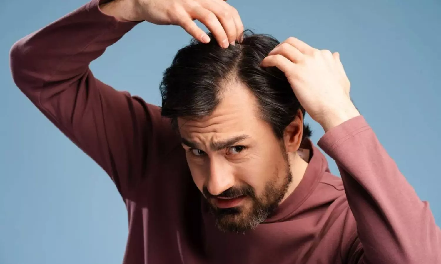 hair fall in men hair fall in men