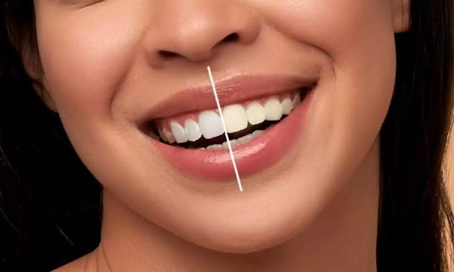 Teeth