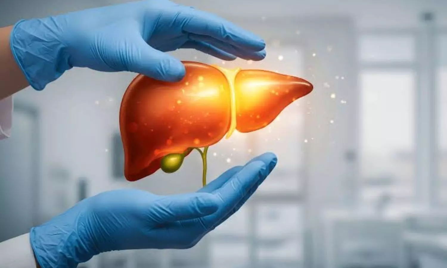Fatty Liver Fatty Liver