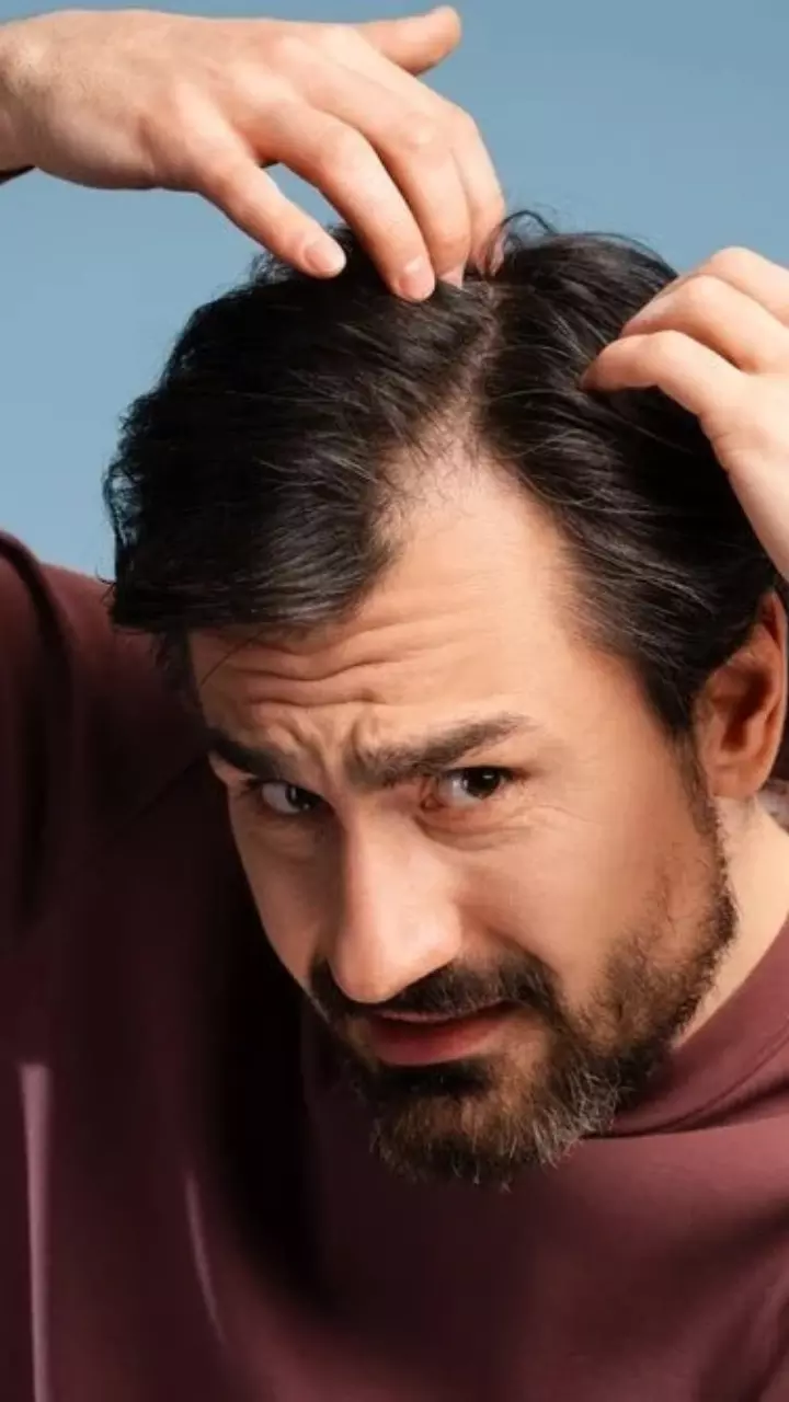 Hairfall Tips: జుట్టు రాలుతోందా.? ముందుగా కనిపించే లక్షణాలు ఇవే!