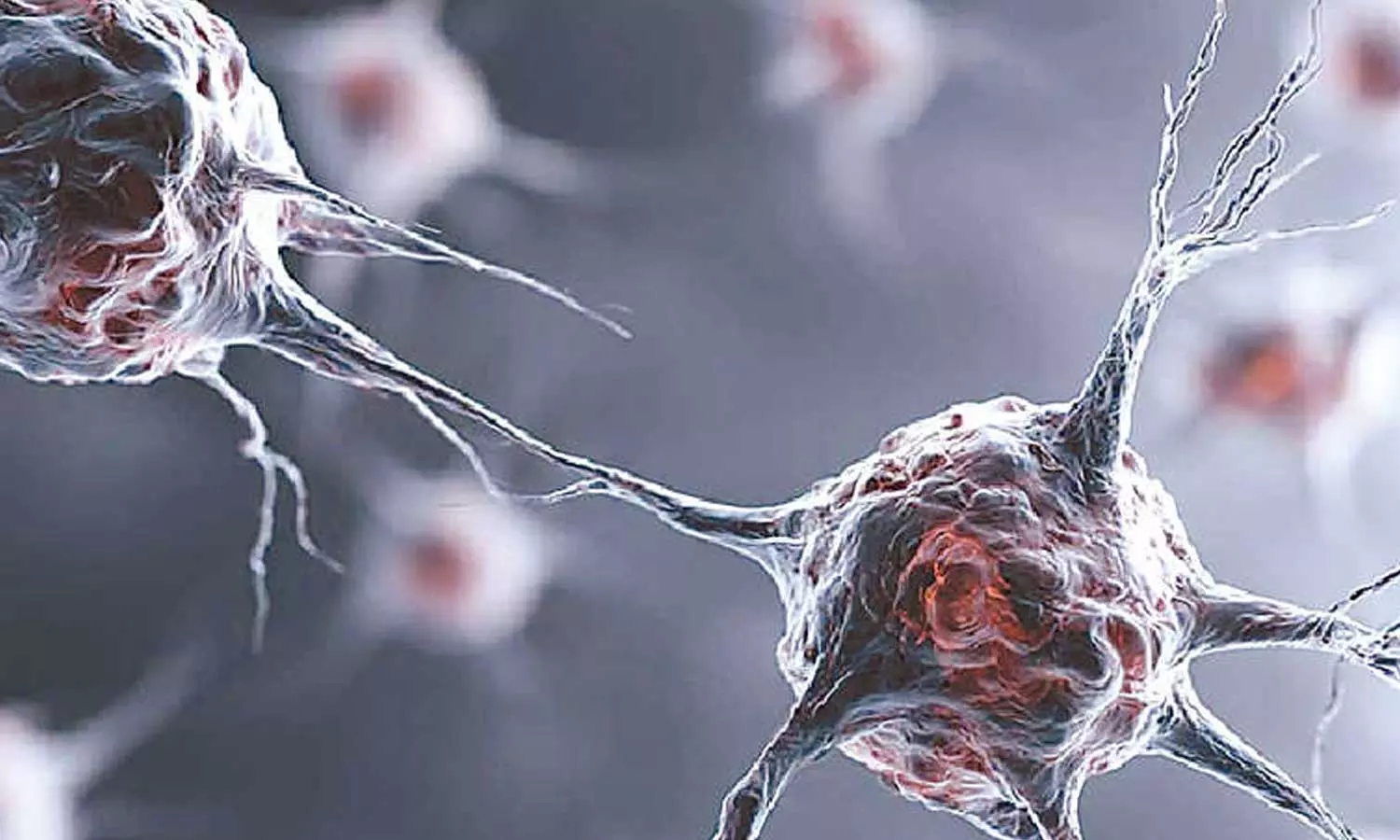 Viral Infections Viral Infections