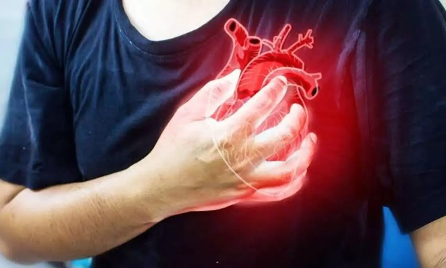 Heart Attack Symptoms