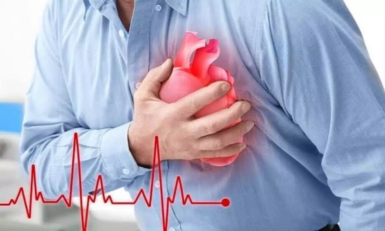 Heart Attack
