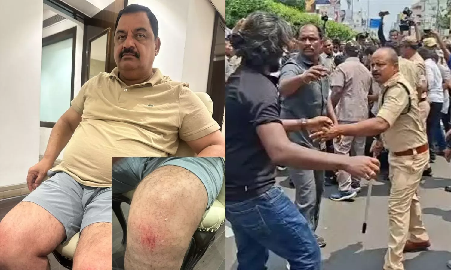 Delhi Delhi