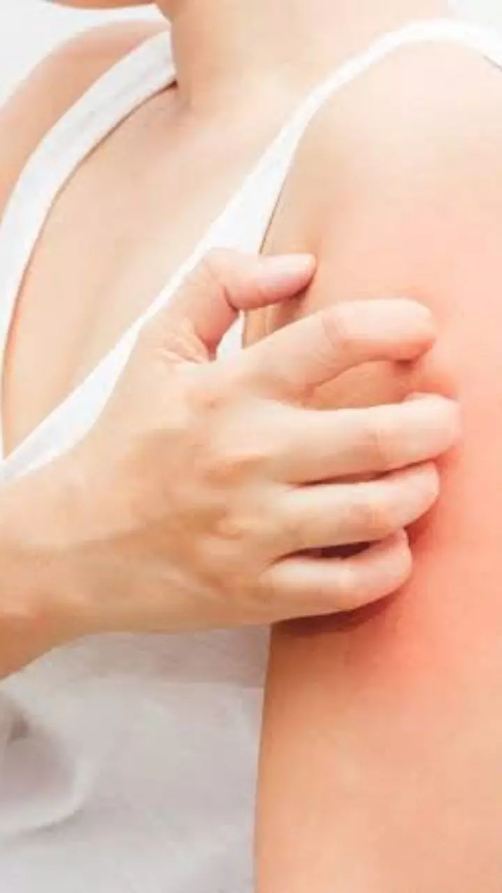 Health care tips: దురద పెట్టిన చోట గోకితే హాయిగా అనిపిస్తుందా? ఆశ్చర్యకరమైన నిజం ఇదే! Health care tips: దురద పెట్టిన చోట గోకితే హాయిగా అనిపిస్తుందా? ఆశ్చర్యకరమైన నిజం ఇదే!